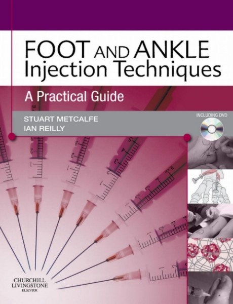 Foot and Ankle Injection Techniques: A Practical Guide