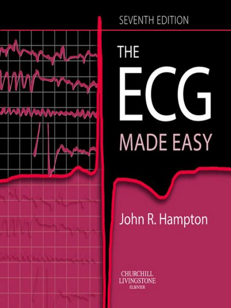 ECG Made Easy