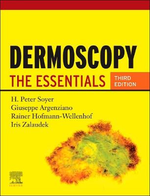 Dermoscopy E-Book: The Essentials
