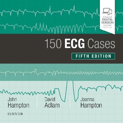150 ECG Cases 5th edition