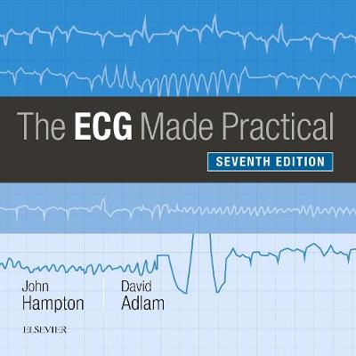 ECG Made Practical
