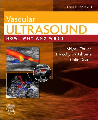 Vascular Ultrasound E-Book: How, Why and When