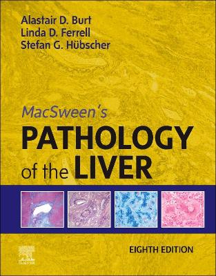 MacSween's Pathology of the Liver, E-Book
