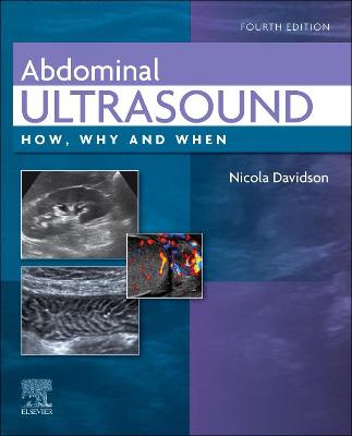 Abdominal Ultrasound: How, Why and When 4th edition