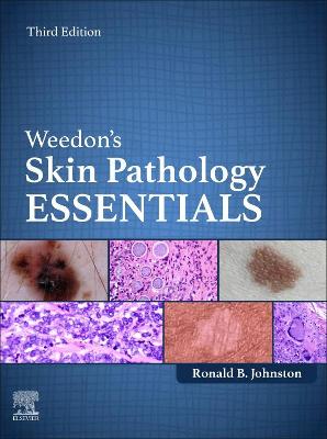 Weedon's Skin Pathology Essentials - E-Book