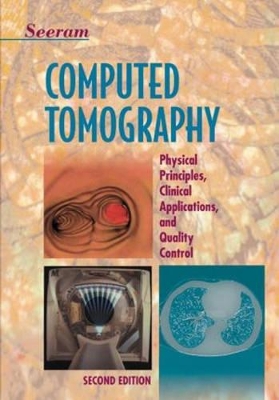Computed Tomography: Physical Principles, Clinical Applications and Quality Control 2nd Revised edition