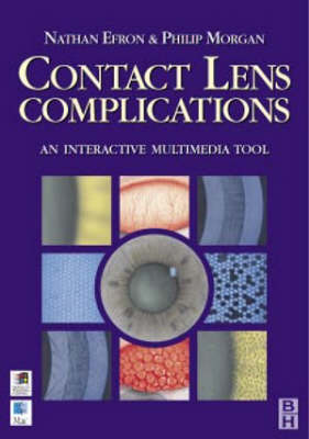 Contact Lens Complications, Interactive Multimedia Tool