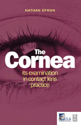 Cornea: Its Examination in Contact Lens Practice