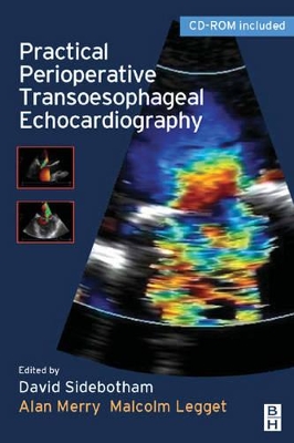 Practical Perioperative Transoesophageal Echocardiography