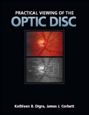 Practical Viewing of the Optic Disc: A Practical Guide