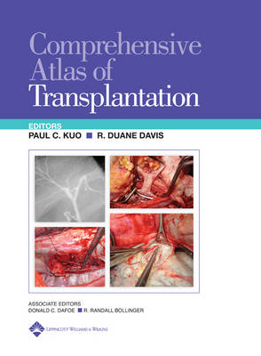 Comprehensive Atlas of Transplantation