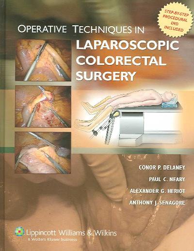Operative Techniques in Laparoscopic Colorectal Surgery