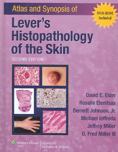 Atlas and Synopsis of Lever's Histopathology of the Skin 2nd Revised edition