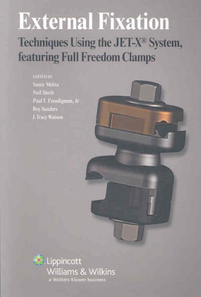 External Fixation: Techniques Using the JET-X System, Featuring Full Freedom  Clamps