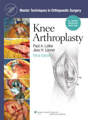 Master Techniques in Orthopaedic Surgery: Knee Arthroplasty 3rd edition