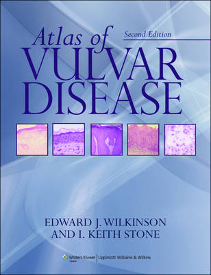 Atlas of Vulvar Disease 2nd Revised edition