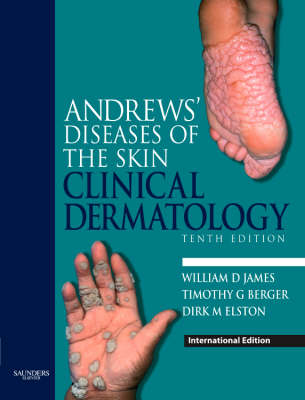 Andrews' Diseases of the Skin, International Edition: Clinical Dermatology 10th Revised edition
