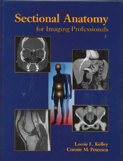 Sectional Anatomy for Imaging Professionals
