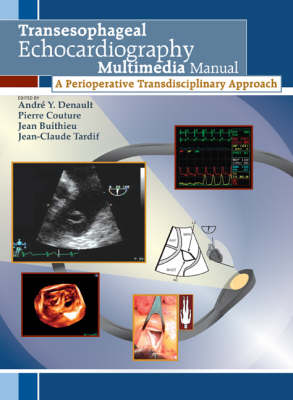 Transesophageal Echocardiography Multimedia Manual, first edition: A Perioperative Transdisciplinary Approach (Book plus DVD)