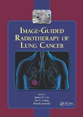 Image-Guided Radiotherapy of Lung Cancer