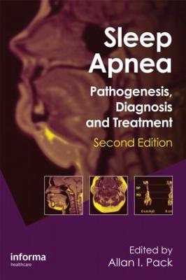 Sleep Apnea: Pathogenesis, Diagnosis and Treatment 2nd edition