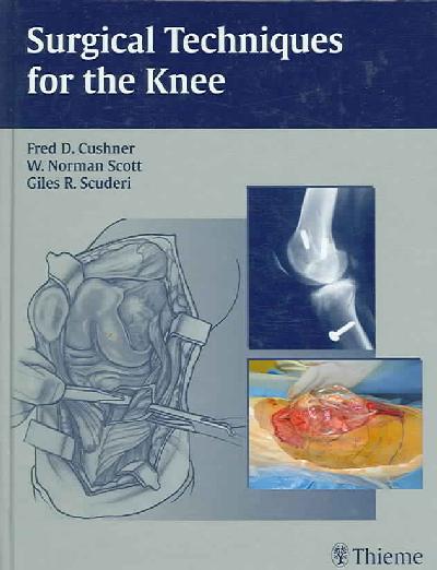 Surgical Techniques for the Knee