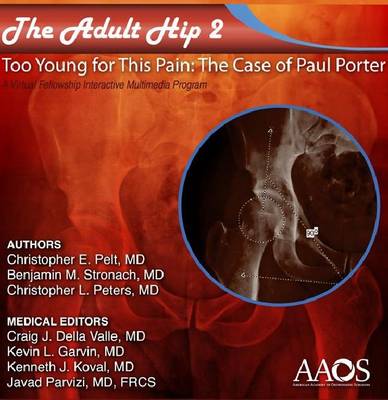 Adult Hip: Case 2 (Acetabular Dysplasia): Too Young for This Pain: The Case of Paul Porter