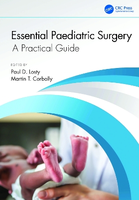 Essential Paediatric Surgery: A Practical Guide