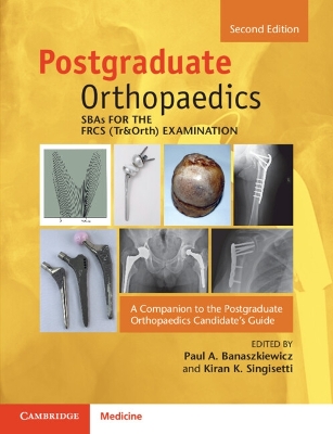SBAs for the FRCS (Tr&Orth) Examination: A Companion to the Postgraduate Orthopaedics Candidate's Guide 2nd Revised edition