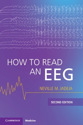 How to Read an EEG 2nd Revised edition