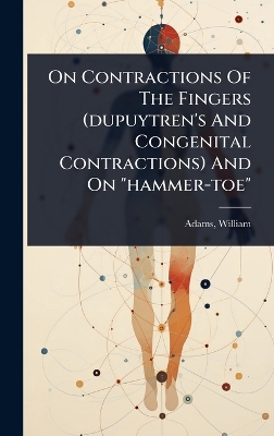 On Contractions Of The Fingers (dupuytren's And Congenital Contractions) And  On hammer-toe