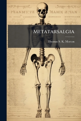 Metatarsalgia