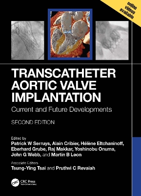 Transcatheter Aortic Valve Implantation: Current and Future Developments 2nd edition