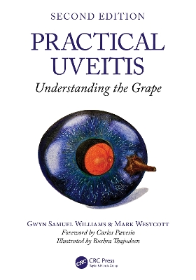 Practical Uveitis: Understanding the Grape 2nd edition