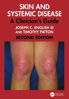 Skin and Systemic Disease: A Clinician's Guide 2nd edition