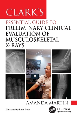 Clarks Essential Guide to Preliminary Clinical Evaluation of  Musculoskeletal X-rays: Evaluating and Commenting on Images