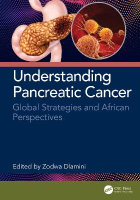 Understanding Pancreatic Cancer: Global Strategies and African Perspectives