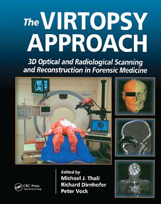 Virtopsy Approach: 3D Optical and Radiological Scanning and Reconstruction in Forensic Medicine