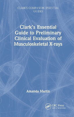 Clarks Essential Guide to Preliminary Clinical Evaluation of  Musculoskeletal X-rays: Evaluating and Commenting on Images