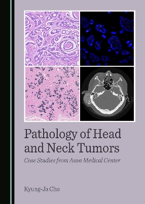Pathology of Head and Neck Tumors: Case Studies from Asan Medical Center