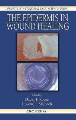 Epidermis in Wound Healing
