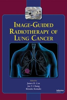 Image-Guided Radiotherapy of Lung Cancer