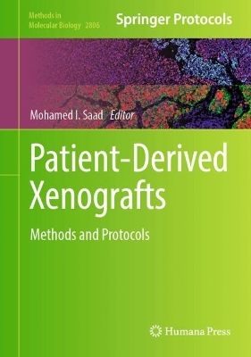 Patient-Derived Xenografts: Methods and Protocols 2024 ed.