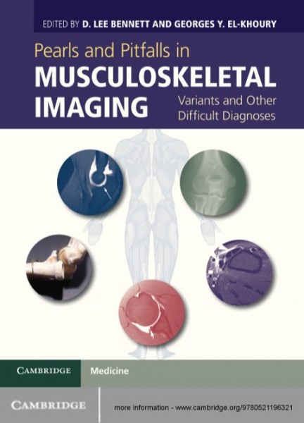 Pearls and Pitfalls in Musculoskeletal Imaging: Variants and Other Difficult Diagnoses