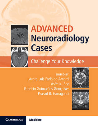 Advanced Neuroradiology Cases: Challenge Your Knowledge