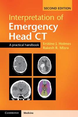 Interpretation of Emergency Head CT: A Practical Handbook 2nd Revised edition