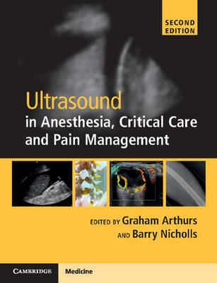 Ultrasound in Anesthesia, Critical Care and Pain Management with Online  Resource 2nd Revised edition