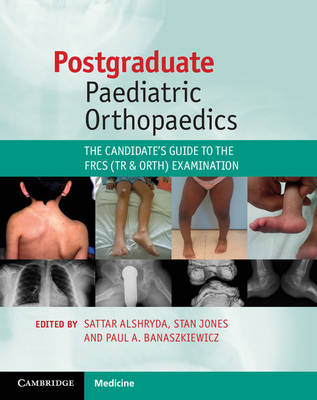 Postgraduate Paediatric Orthopaedics: The Candidate's Guide to the FRCS (Tr and Orth) Examination