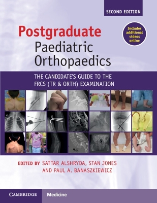Postgraduate Paediatric Orthopaedics: The Candidate's Guide to the FRCS(Tr&Orth) Examination 2nd Revised edition