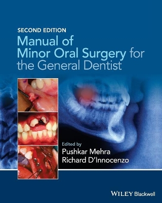 Manual of Minor Oral Surgery for the General Dentist 2nd edition